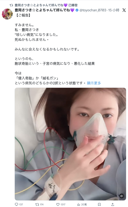 【博狗扑克】豊岡さつき(丰冈沙月)自爆罹患罕见疾病、可能致命！【EV扑克下载】